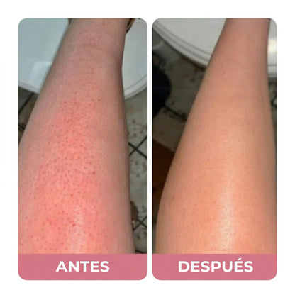 Razerly™️ | Depilación sin irritación ni vellos encarnados.