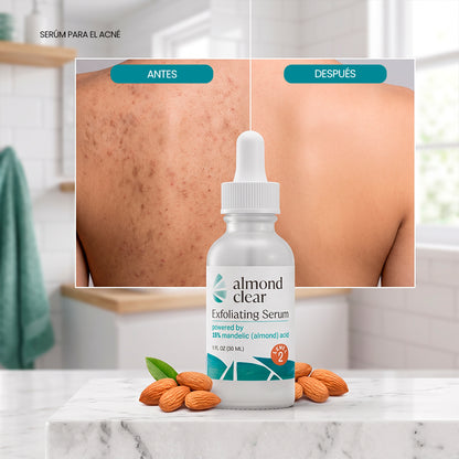 Elimina el Acné Corporal y la Foliculitis desde la Raíz